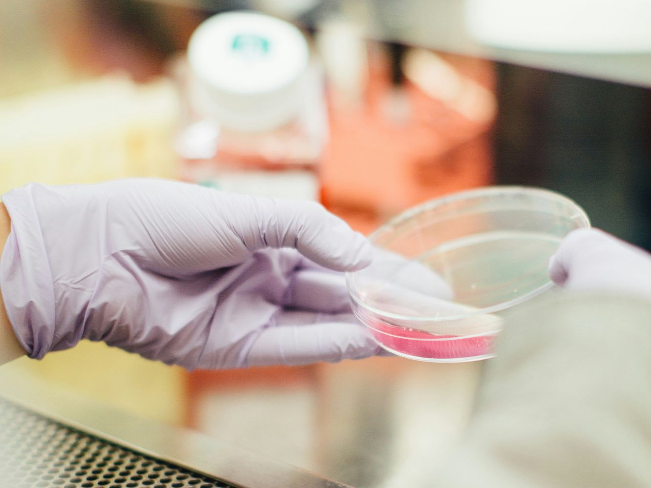 person wearing gloves holding a petri dish